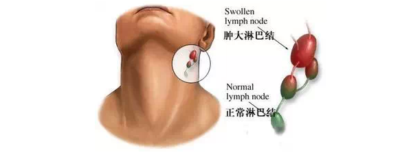 艾艾贴可以调理腺肌症吗？