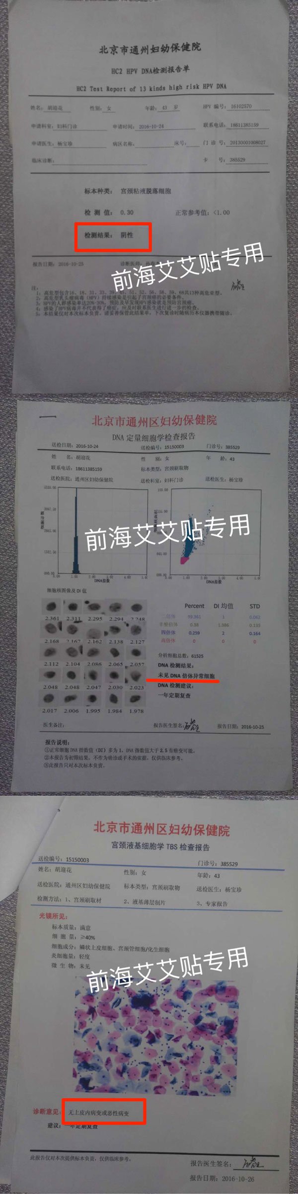 用艾艾贴如何调理手抖？