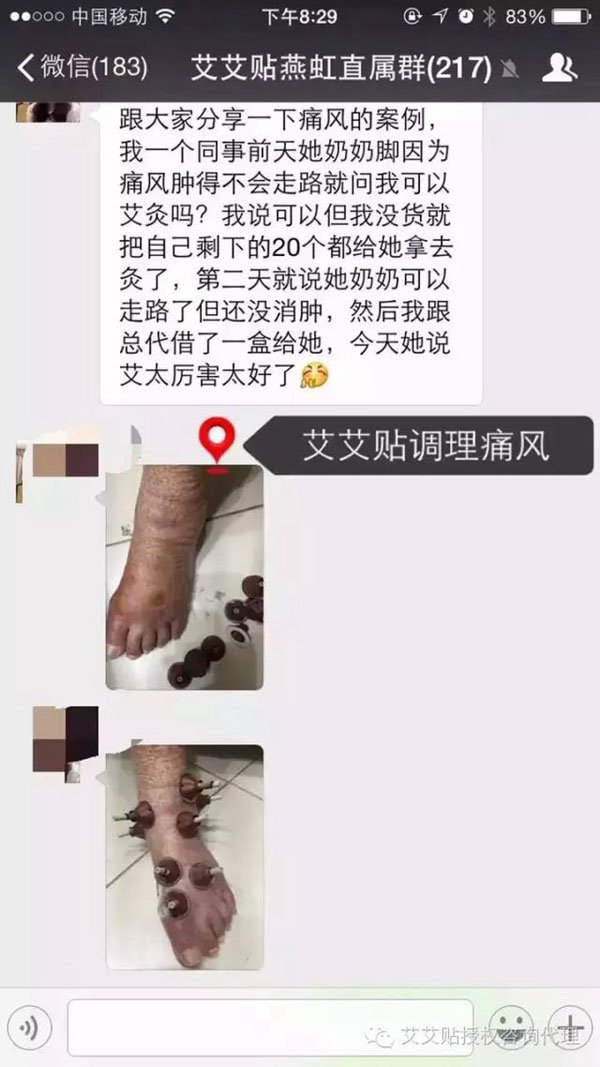 中元节如何用艾艾贴艾灸养生？