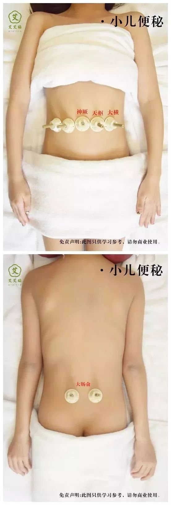 女人一定要注意寒湿体质